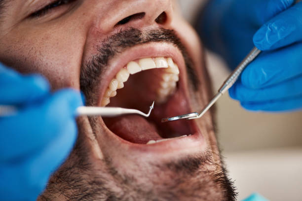 Best Sedation Dentistry  in Woodcreek, TX